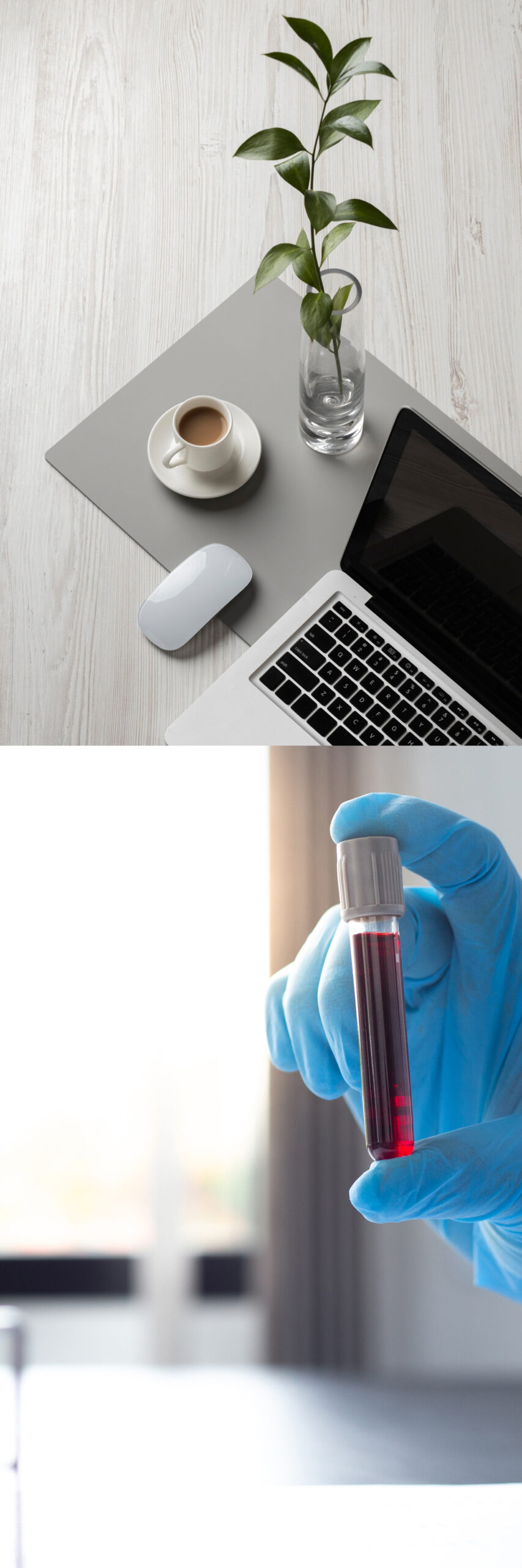 Összetett kép az otthonról elérhető szolgáltatások szemléltetéséhez, mely tartalmaz egy hangulatképet laptoppal és kávéval valamint egy ampulla vért, amit egy laborelemző tart a kezében.